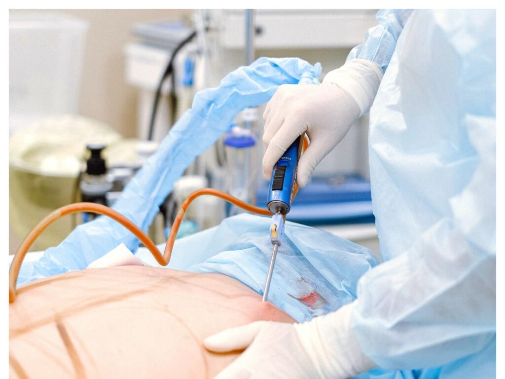 Smart Lipo for Beginners: Your First Consultation and What Really Happens